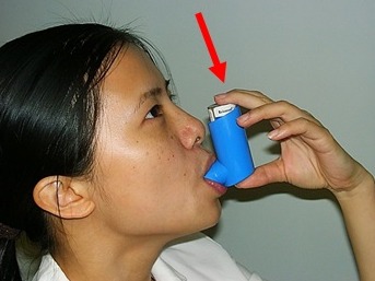 哮喘可控可治！规范治疗、科学管理这样做