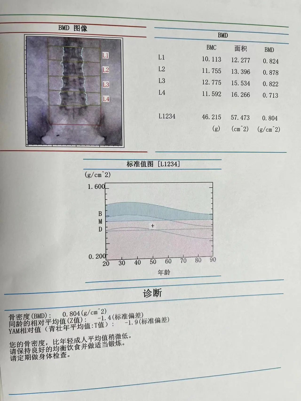 骨密度检测仪原理图片