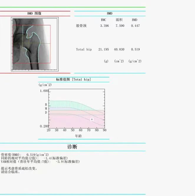 深度天极网_智能设备_智能手表
