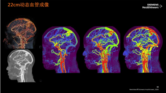 双源cta图片