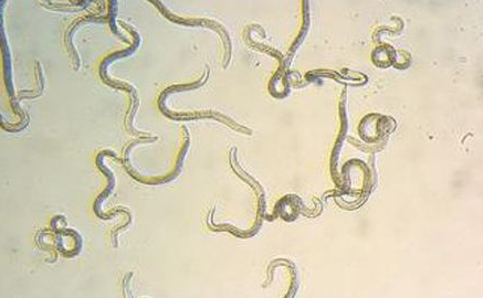 科学家从蛔虫身上找到哮喘治疗新线索