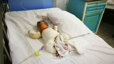2个月大婴儿特重度烫伤被父亲弃医院？知道真相的小编哭了...