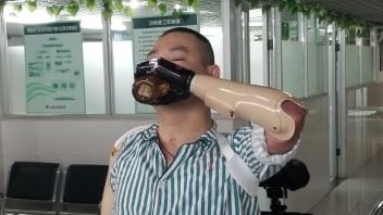 不仅能喝水，还能敲键盘！广东成功安装首例智能仿生手