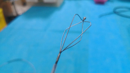 10岁熊孩子吞下4颗钢珠1块磁铁，医生用网篮成功打捞