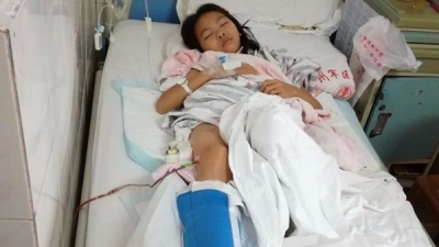 谁来救救她的腿？五华小女孩得重疾，不手术恐难行走
