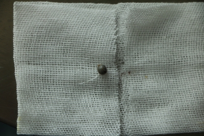 惊悚！平远女子耳痛就医，耳内竟然取出一只活生生的…