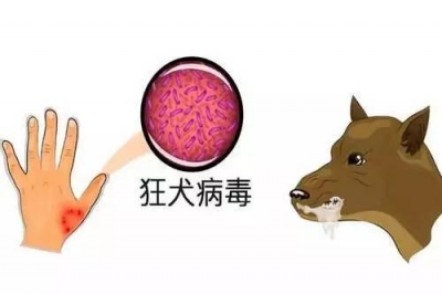 夏季犬猫伤人高发，市疾控中心提醒：受伤后酒精涂抹有刺痛要及时就诊