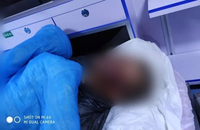 连人带车翻下约20米的山底深处，受伤严重！他紧急求助警方...