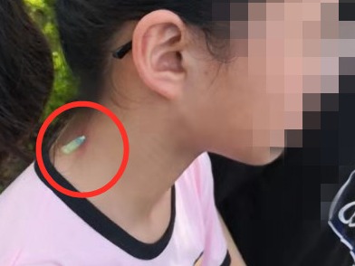 五华微信群传“男子用针筒扎伤10多岁女孩”，男子已被警方控制！