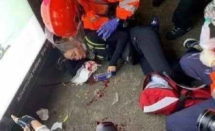爆眼女收黎智英500万封口费后“被消失”  出镜者系冒充