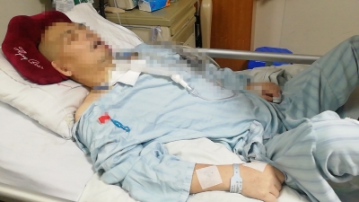 帮帮他吧~意外被高空坠物砸成重伤，高昂的医疗费用让梅县这男子陷入绝境！