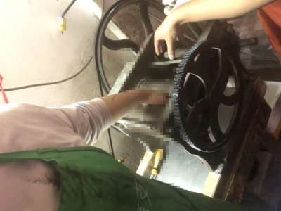 压面机又“咬手”！五华一女子半只手掌被卷了进去...