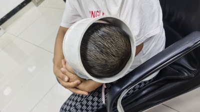 1岁多幼儿头卡PVC管道出不来，额头水肿...家长急驰消防站！
