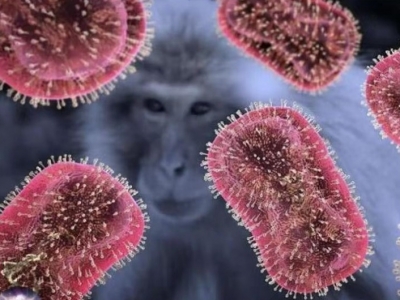 如何科学应对猴痘病毒？专家回应热点关切