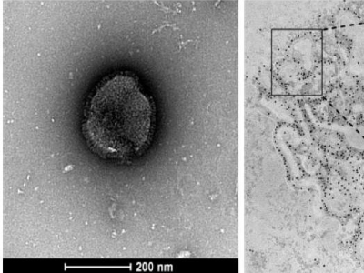 中疾控：预计美国前期人偏肺病毒疫情对我国影响有限