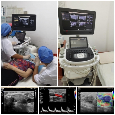 平远县人民医院超声科： 一双“超声慧眼”让诊治更精准