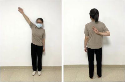 【精准定位 无痛松解】大埔县人民医院康复医学科三联疗法，助您轻松告别肩周炎！