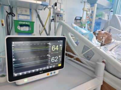 小仪器点亮大脑“缺氧红绿灯”！梅州市首例近红外脑氧监测技术成功助力昏迷患者抢救