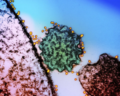 尼帕病毒怎样传播？如何提早预防？一文了解